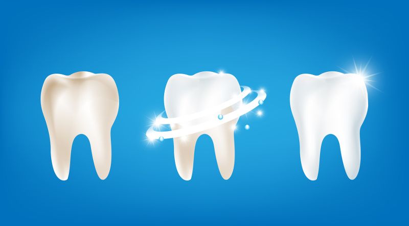 Metody wybielania zębów